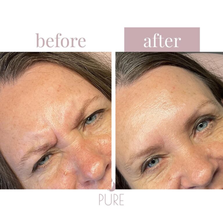 Instagram post from klinikpure. This post is in position 3.