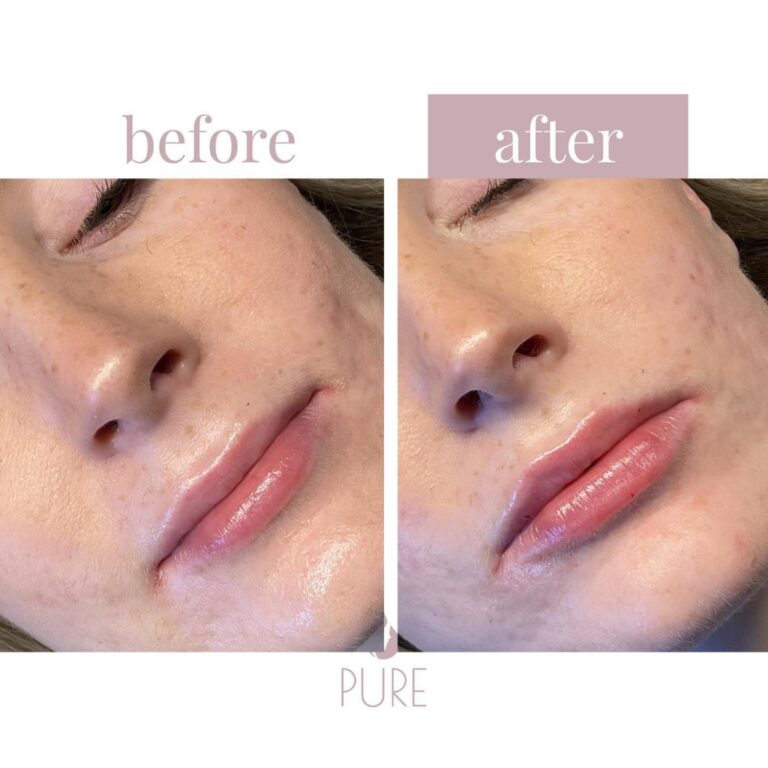 Instagram post from klinikpure. This post is in position 1.