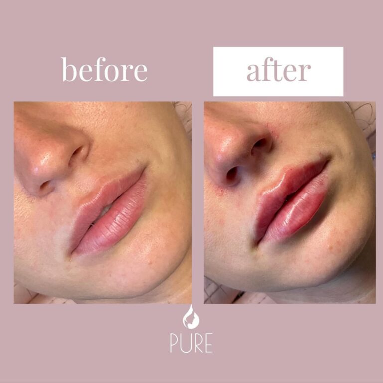 Instagram post from klinikpure. This post is in position 4.