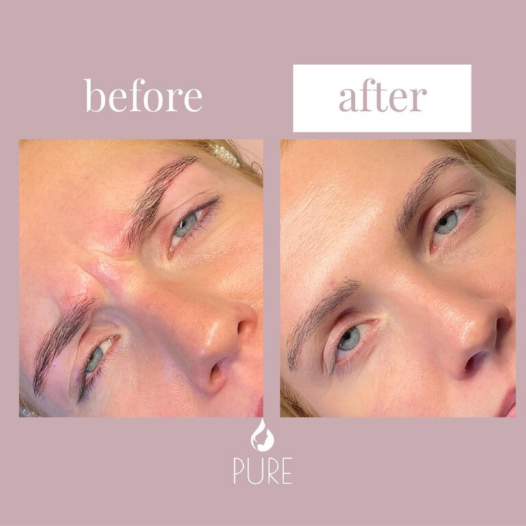 Instagram post from klinikpure. This post is in position 2.